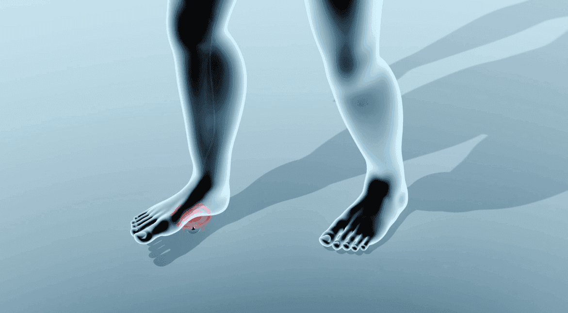Beyond Biomechanics: The Role of Afferent Irritants in Muscular Inhibition